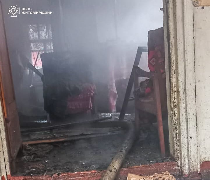 У Радомишлі під час пожежі в будинку постраждав 71-річний пенсіонер