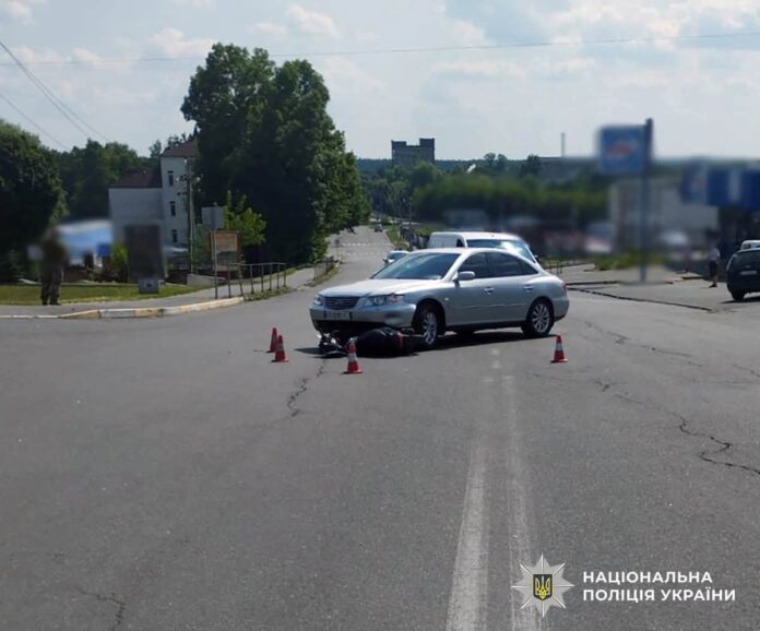 ДТП у Малині: зіткнення Hyundai зі скутером завершилося госпіталізацією пасажирки