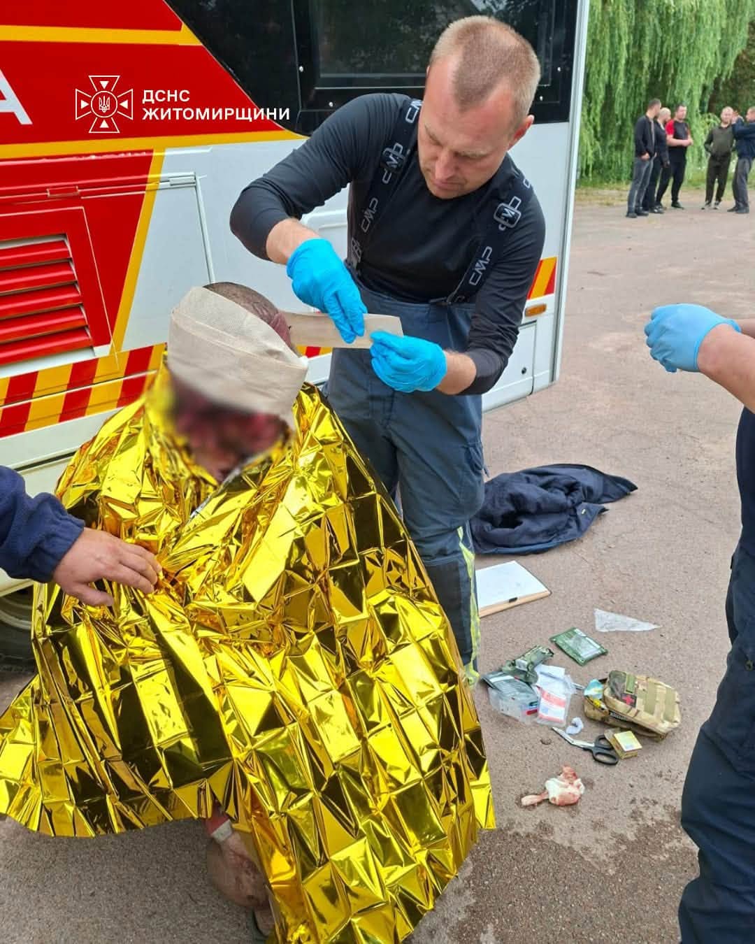 Удар по Коростенському району: до лікарні звернулися близько десяти постраждалих